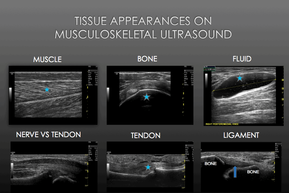 Musculoskeletal Ultrasound - Where do I begin?